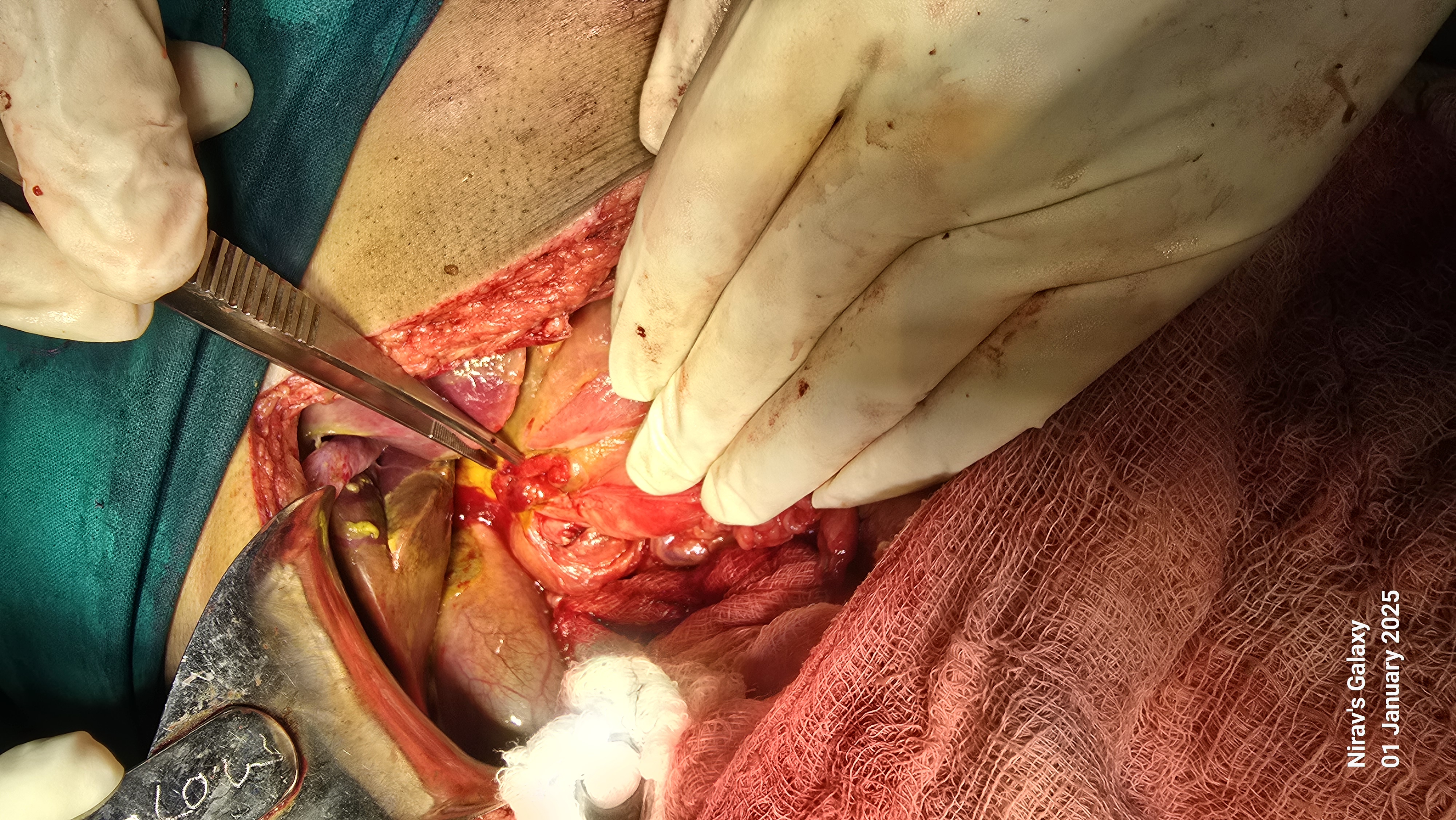 Emergency Surgery illustration