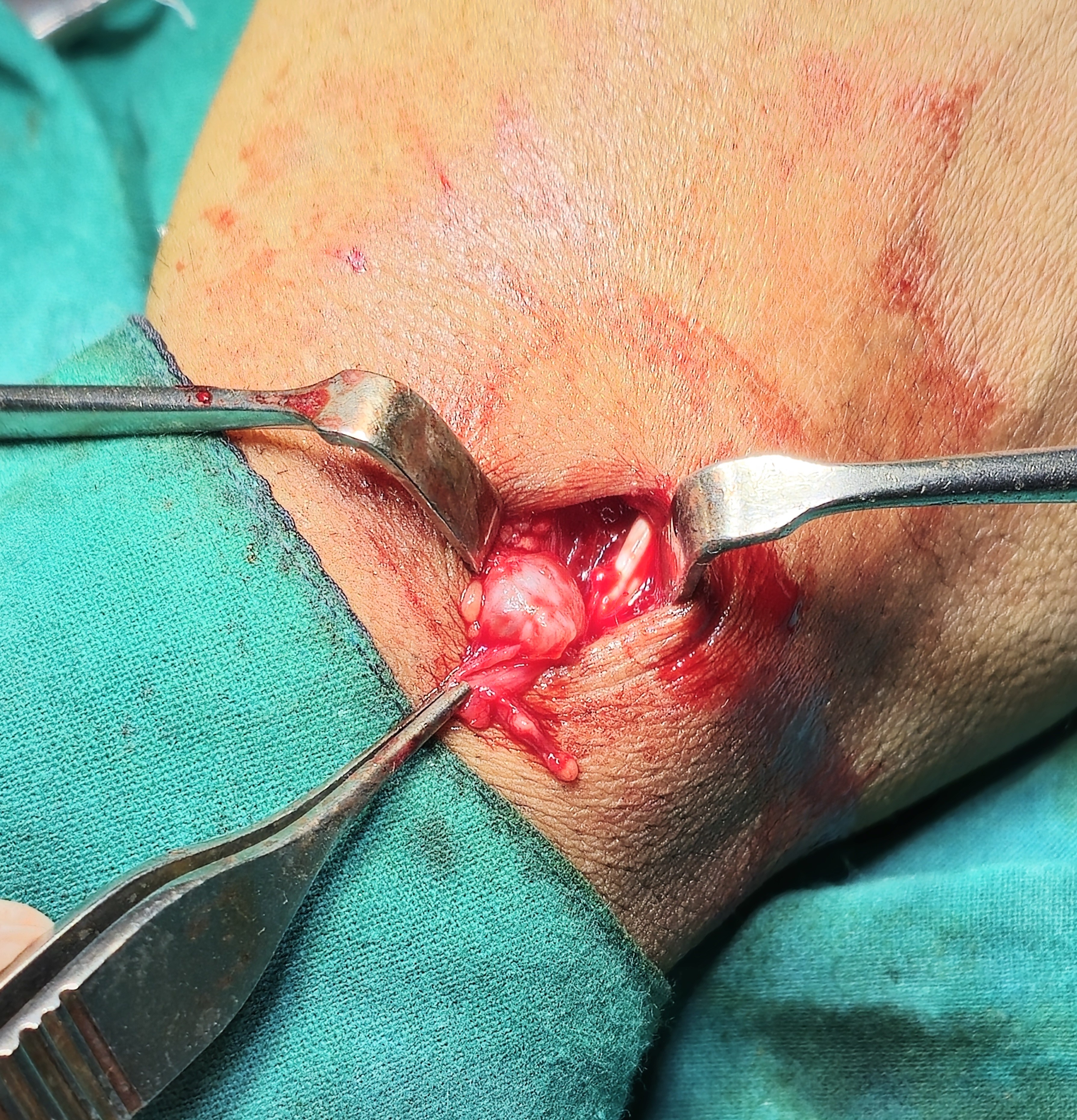 Minor Surgeries illustration